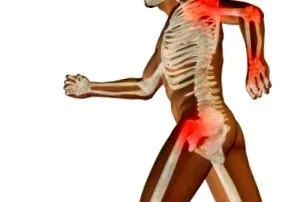 osteoartrită condroitină