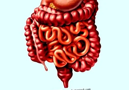 intestinului