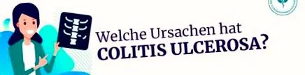 vastagbélgyulladás
