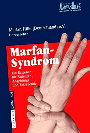 betegség marfan-szindróma