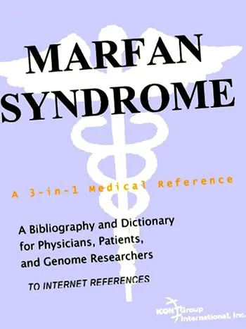 marfan-szindróma betegség