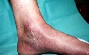 medicului