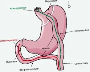 gyomor