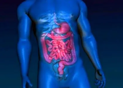 diabetes gastroparesis