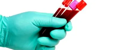 diabetului