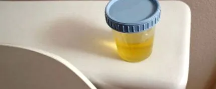 Cukorbetegség útmutató cukorbetegség