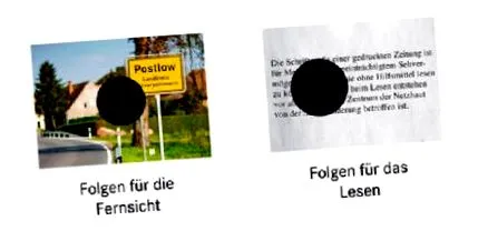 útmutató cukorbetegség