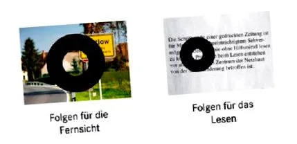 diabéteszes Cukorbetegség útmutató