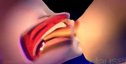 chisturile