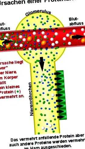 vizeletben