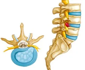 eurospine