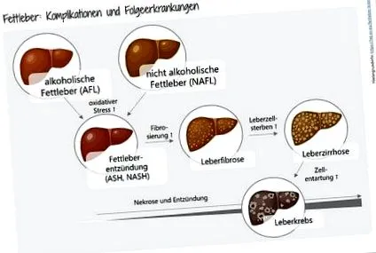 nutrițională