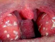 diagnostic