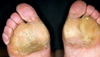 cauze diagnostic