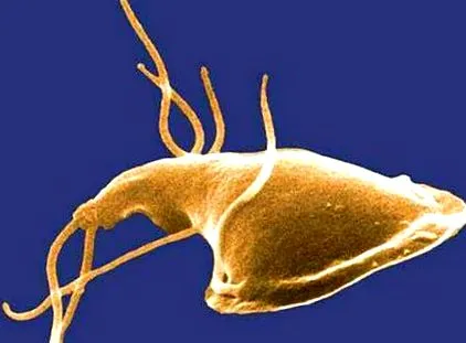 giardiasis