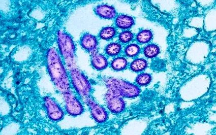 influenza