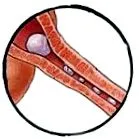 diagnostic diagnostic