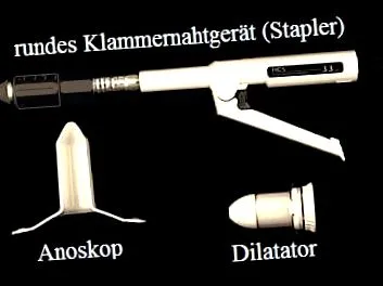 természetes kezelés