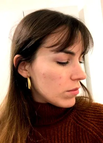 hormonală