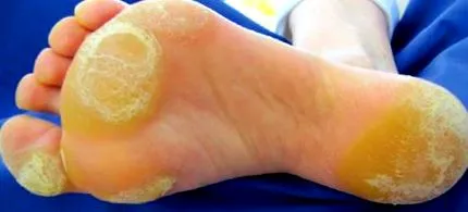 dermatolog