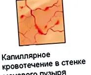 причини