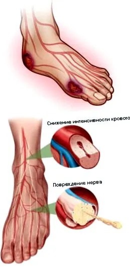 duzzanata