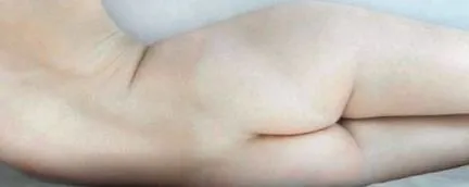 chirurgie