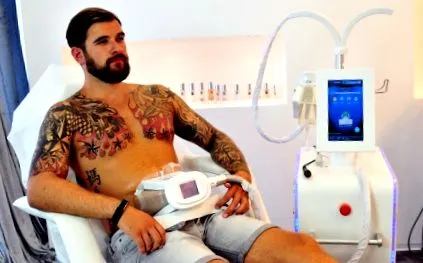 coolsculpting