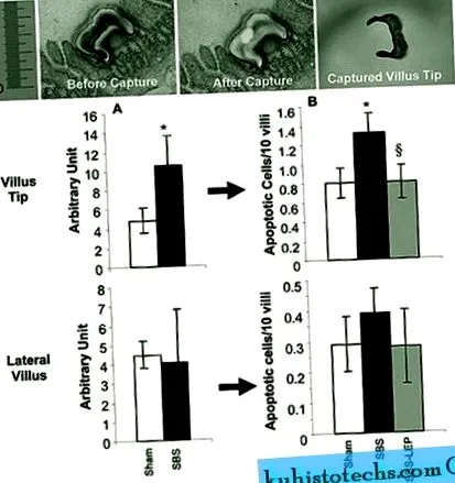 leptin