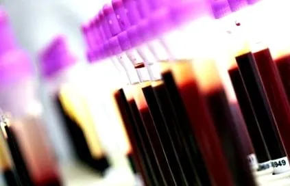 lupus