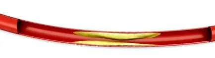 kalcium magnézium