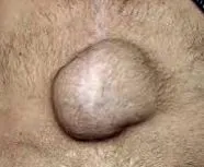 причини