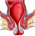 rectal