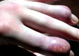 http rheumatologe