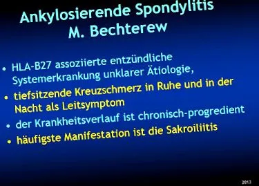 axiális spondyloarthritis