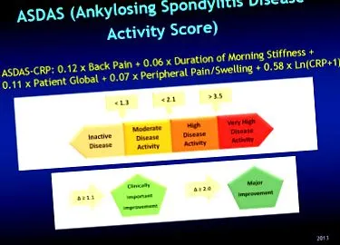 axiális spondyloarthritis