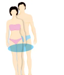 sculpsure