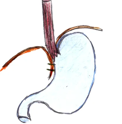toracic