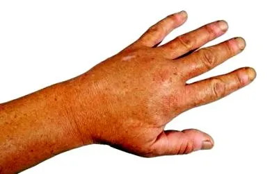 testben