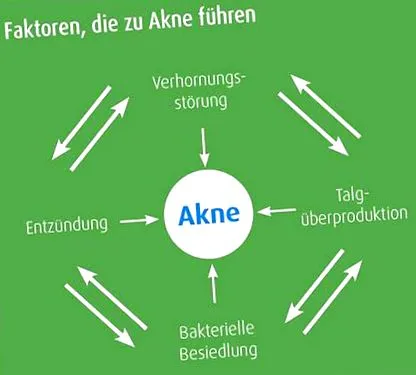 akne
