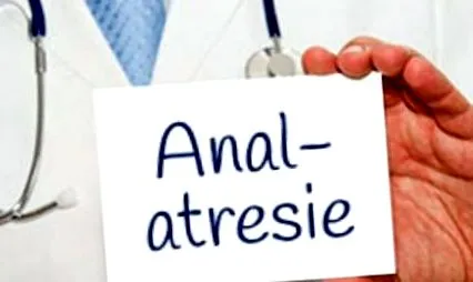 anală este