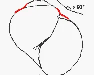 45-65