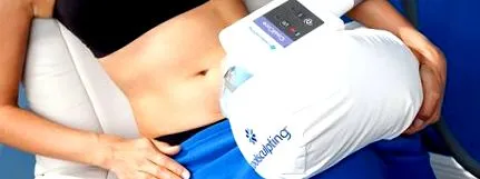 cryolipolysis