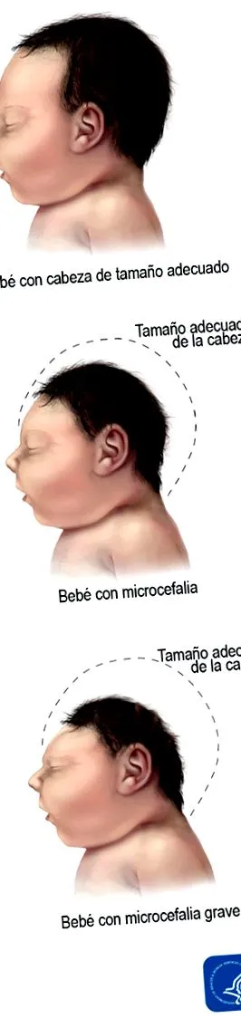 cdc-ről