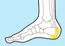 heel