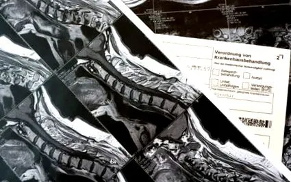 рбетниот канал