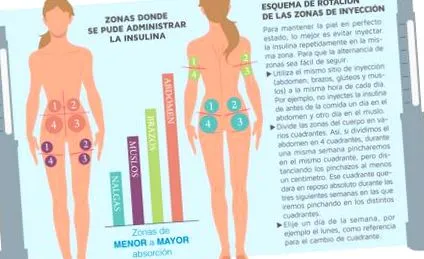 szúrás