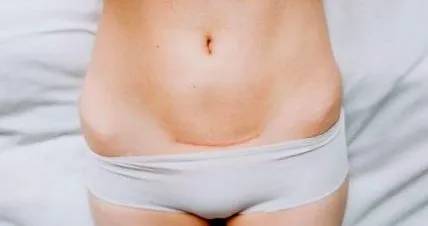 heggyógyítás