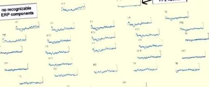 употреба ефектите