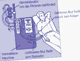 teljes